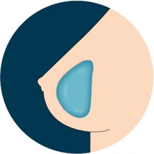 breast-gel-implant Sex Puppe Gel Brüste