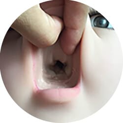 Sin dientes - Función oral