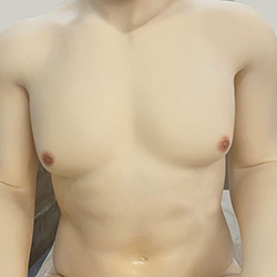 White Skin