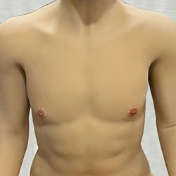 Flesh Skin