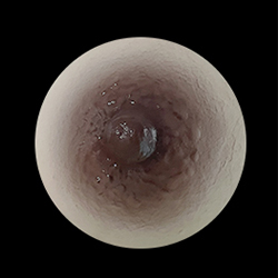 No.2