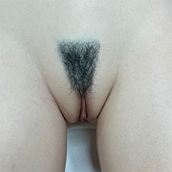 Pubic Hair #2