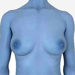 Blue Skin