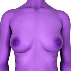 Purple Skin