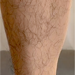 Legs Hair
