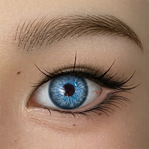 Eyes with Bloodshot #3