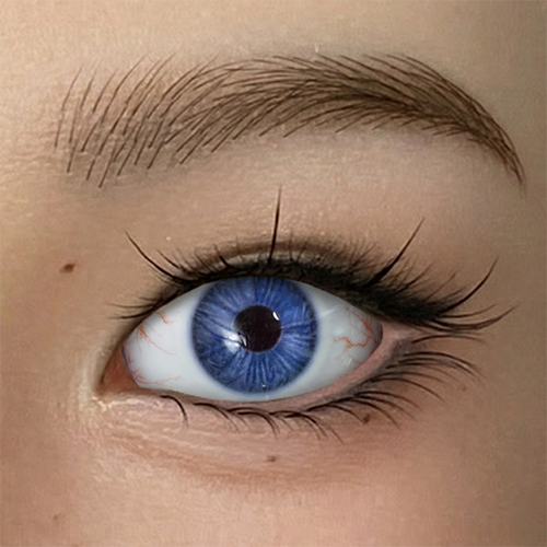 Eyes with Bloodshot #5